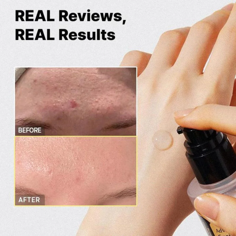 اسنس الحلزون كوزركس - 100مل | COSRX Snail Mucin 96% Power Repairing Essence - Image 3