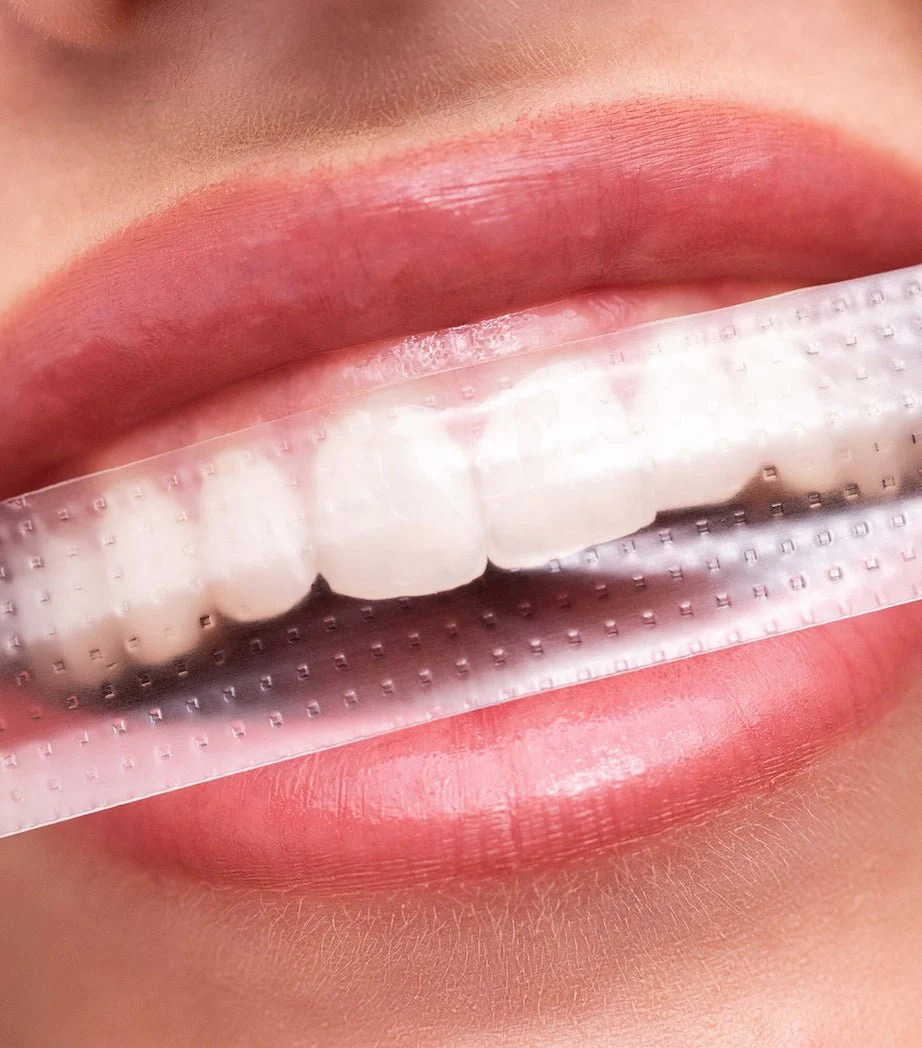 شرائط تبييض الاسنان هايسمايل - 14قطعة | Hismile teeth whitening pap stripes - Image 2